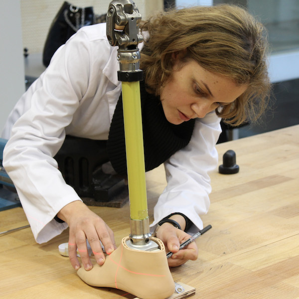 Anissa Gaid doing static alignment of prosthesis
